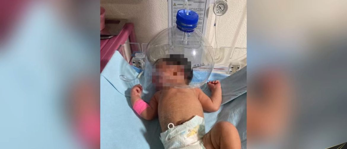 Médico de Macuspana improvisa campana cefálica para salvar a bebé y toman represalias en su contra