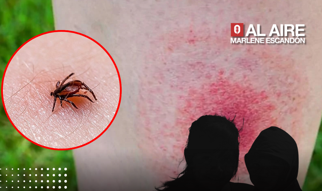 Fallecen dos hermanos por mordedura de garrapata en Coahuila; autoridades emiten alerta epidemiológica