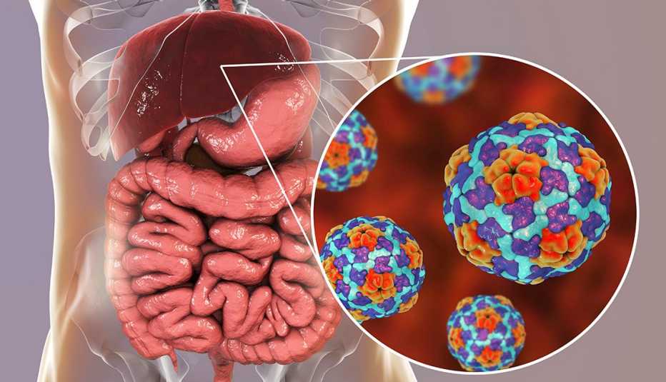Confirma Salud que hubo brote de hepatitis A en el CREST